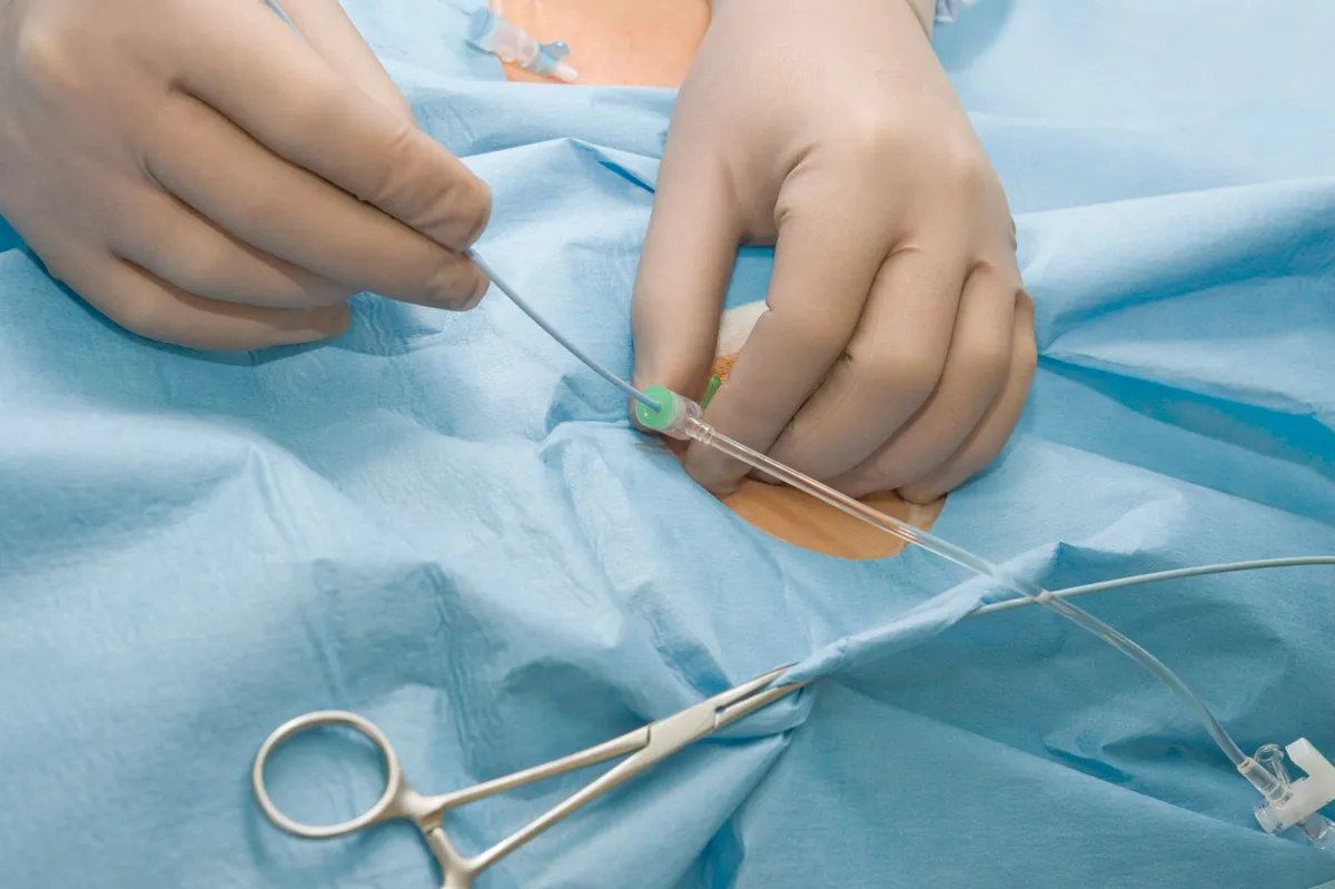 A doctor performing Cardiac Catherization