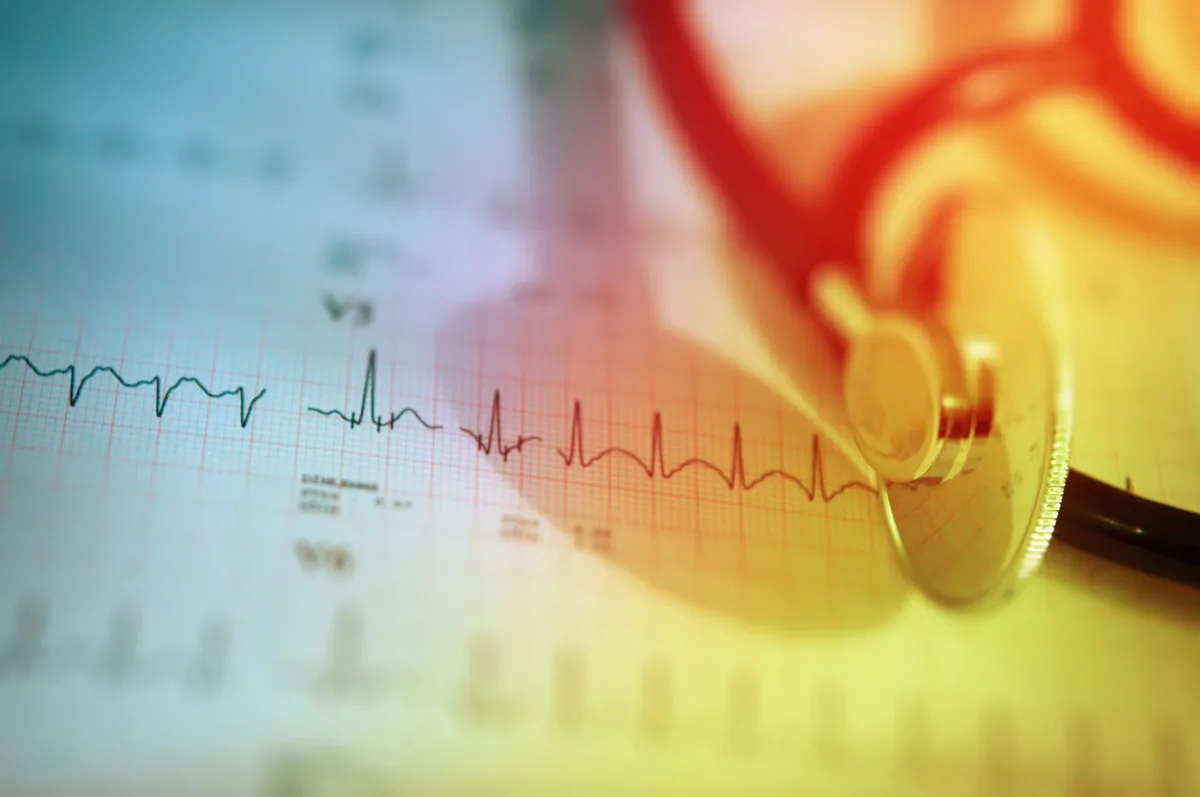 A stethoscope placed on a cardiogram