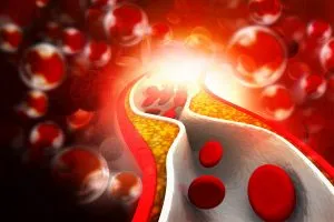 An illustration of blood cells flowing through an artery