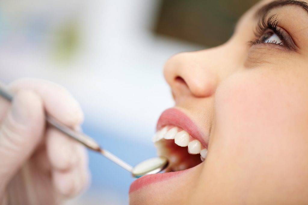 getting Dental Filling 33323