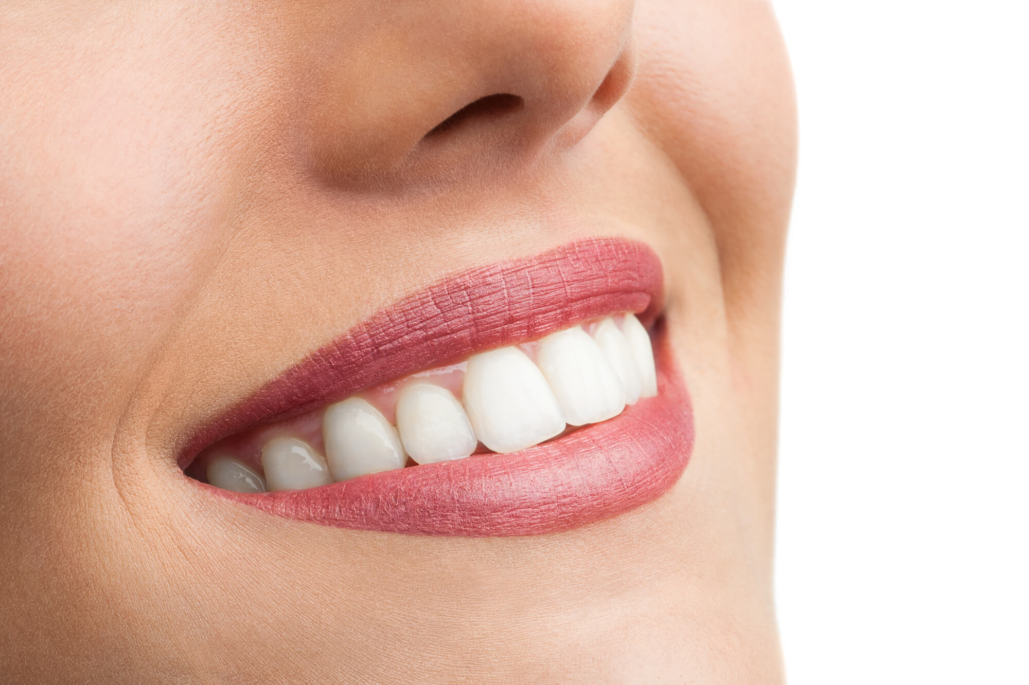 smile Clear Aligner 33304