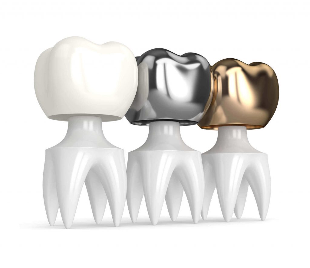 three types of Crowns in 33330 