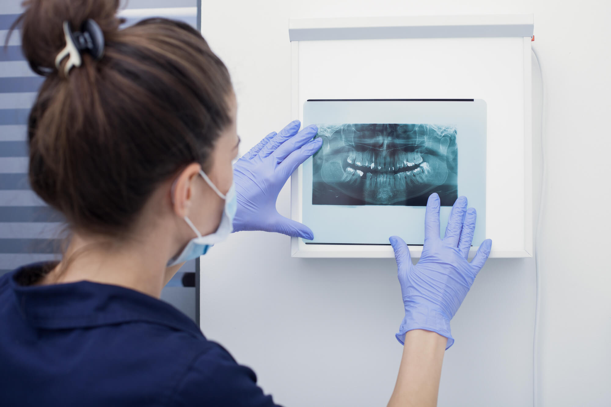 Dental X-rays in plantation fl 