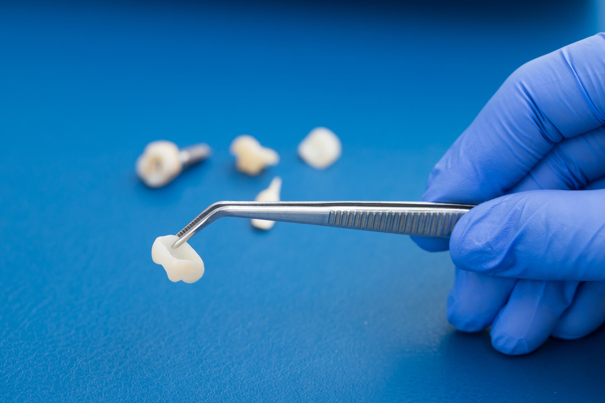 Dental Crowns in Davie, FL over blue surface