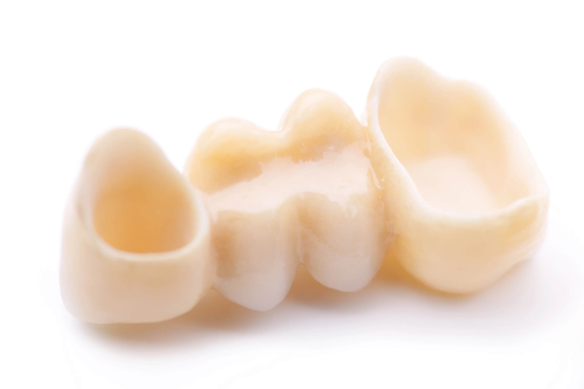Dental Crowns in Davie, FL over white surface