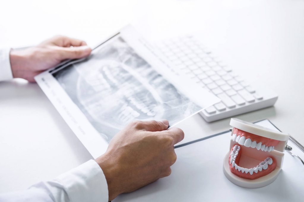 Consult about dental crowns in plantation fl