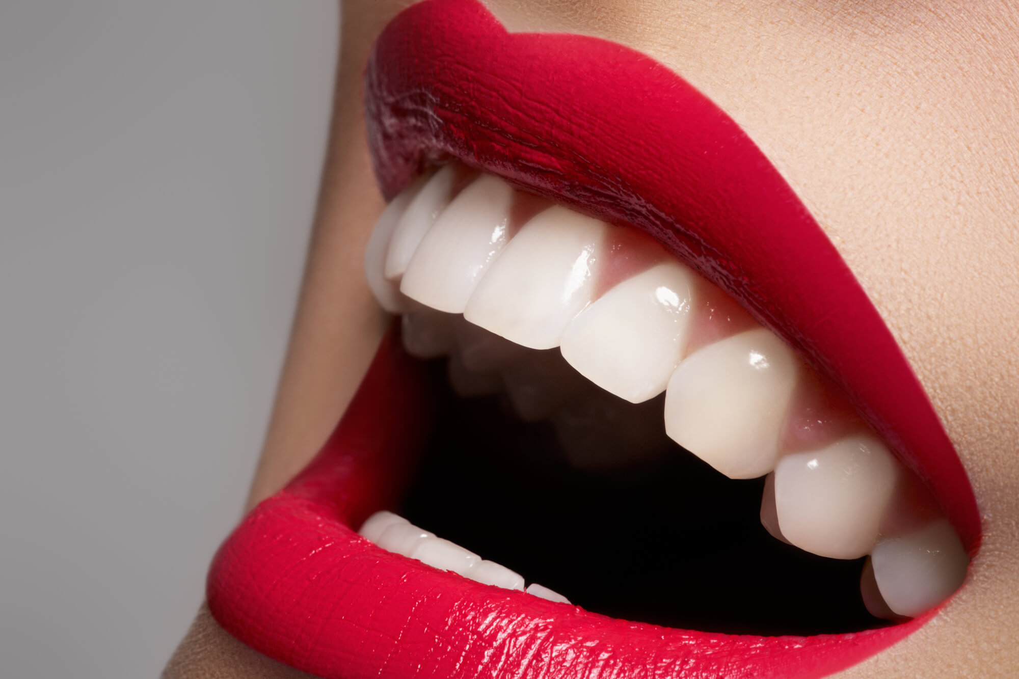 plantation teeth whitening patient