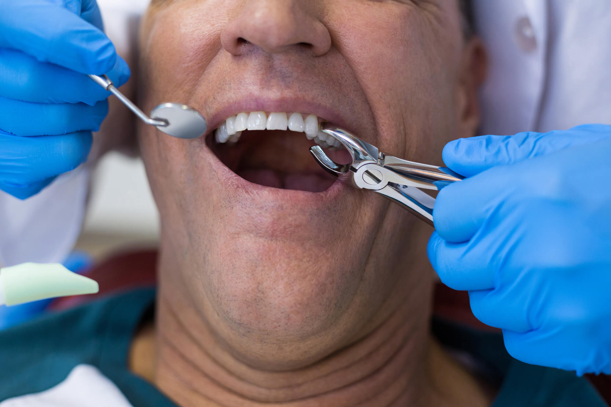 man during tooth Extraction in plantation fl.jpg