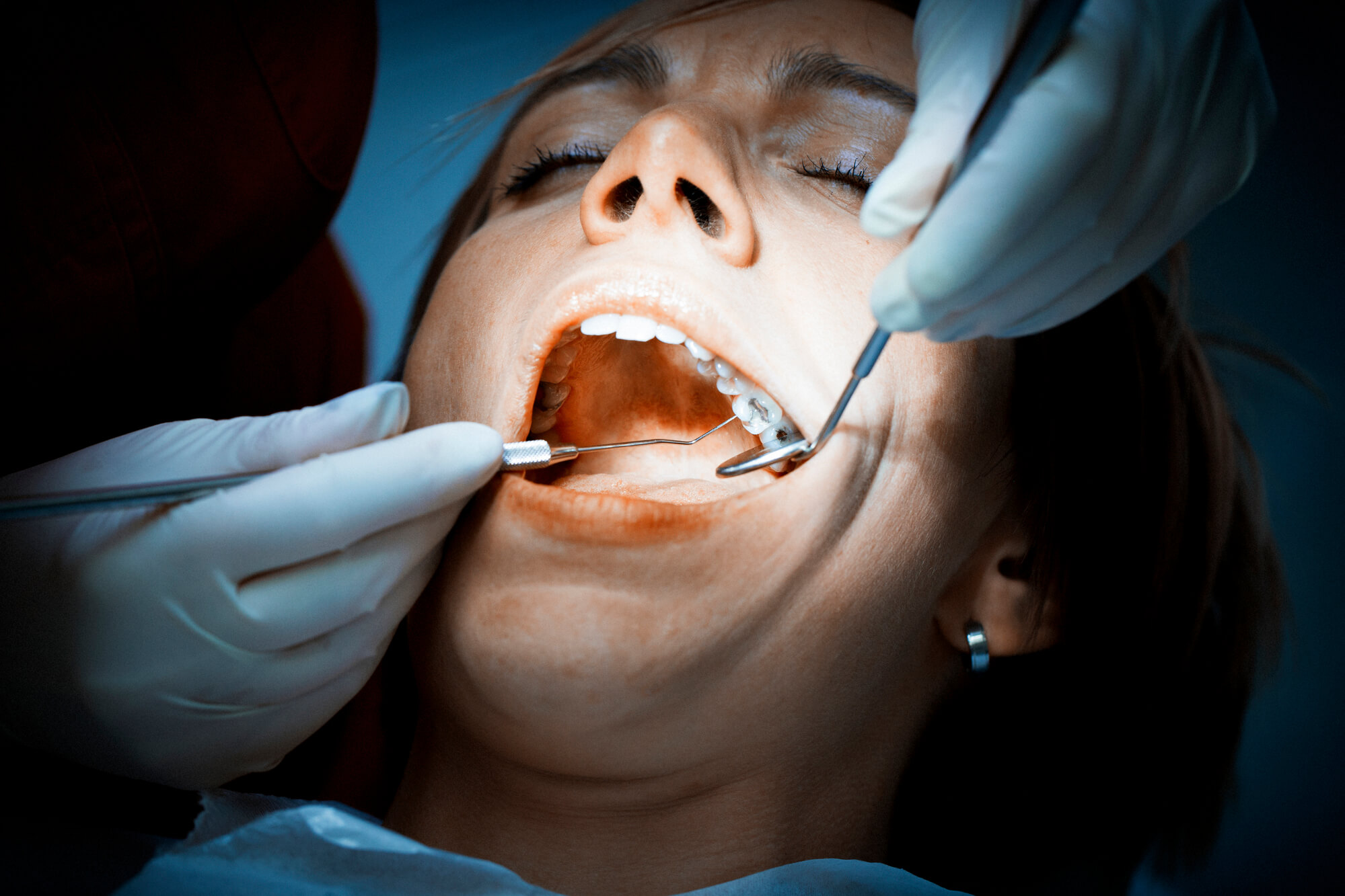 dental professional performs an emergency dentistry in Plantation, FL