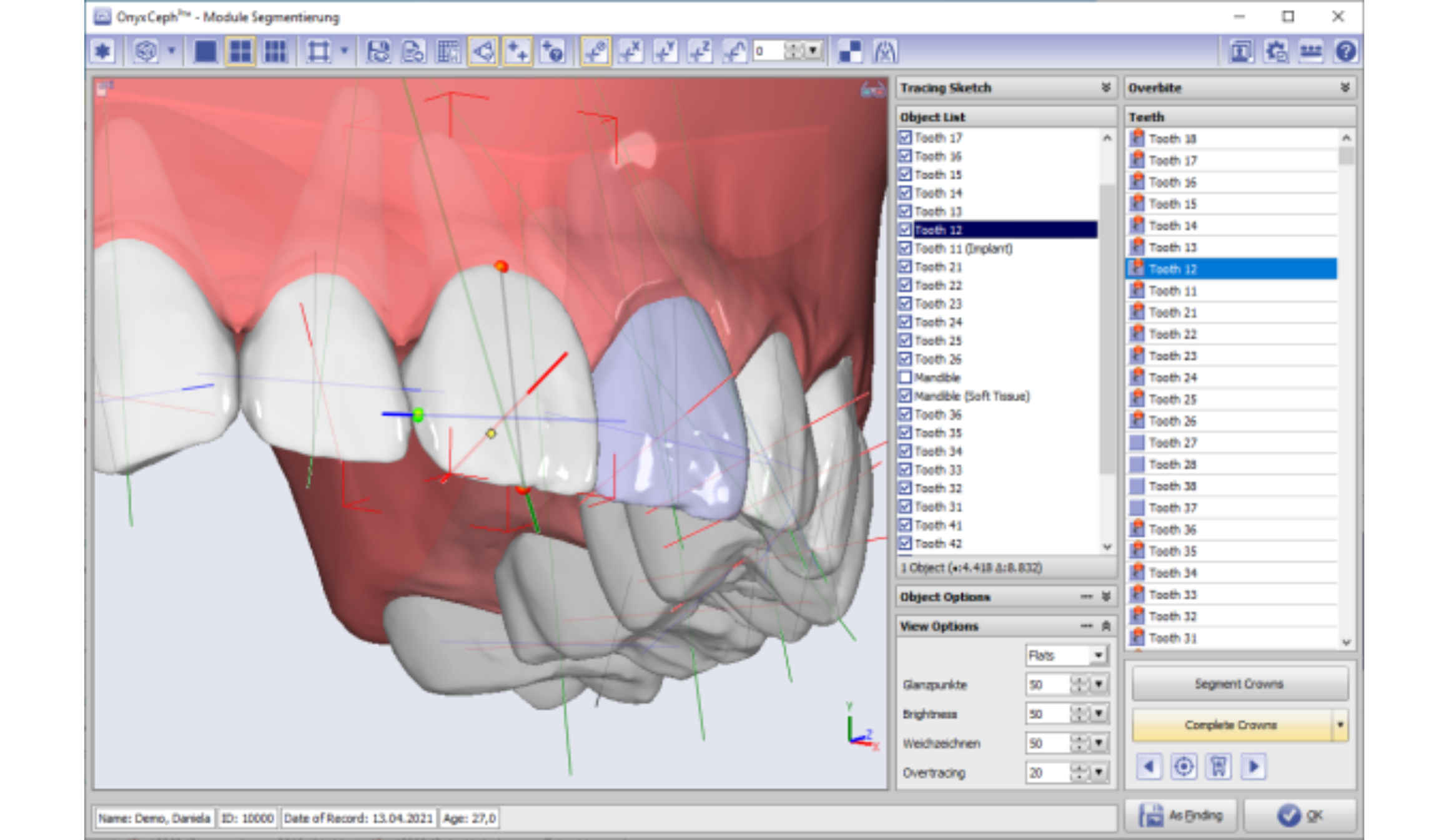 Essential Tips for Precision in Dental Segmentation