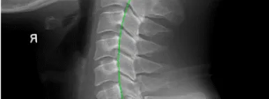 Unhealthy Spine