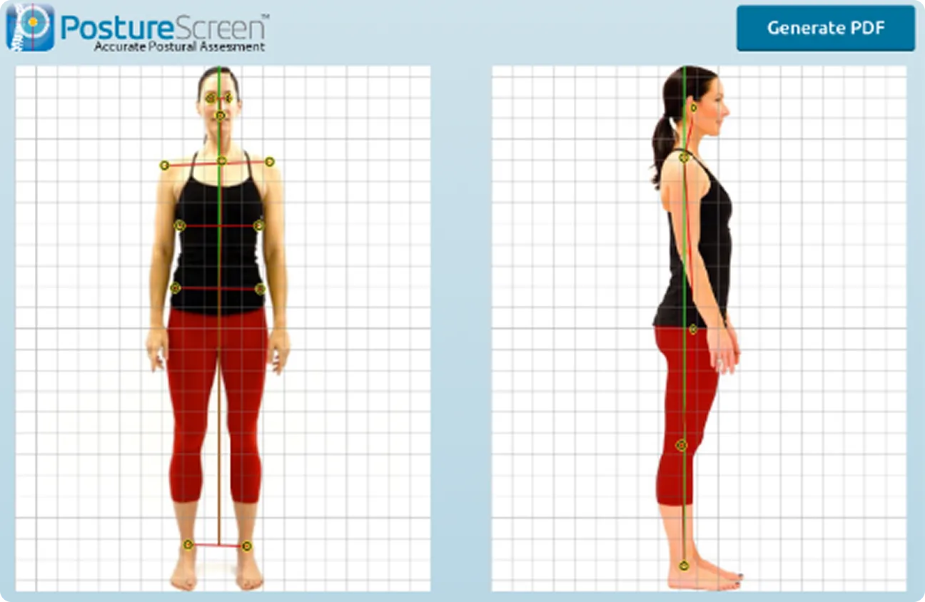 Posture Scan