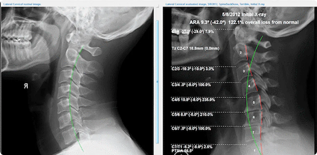 X-Ray
