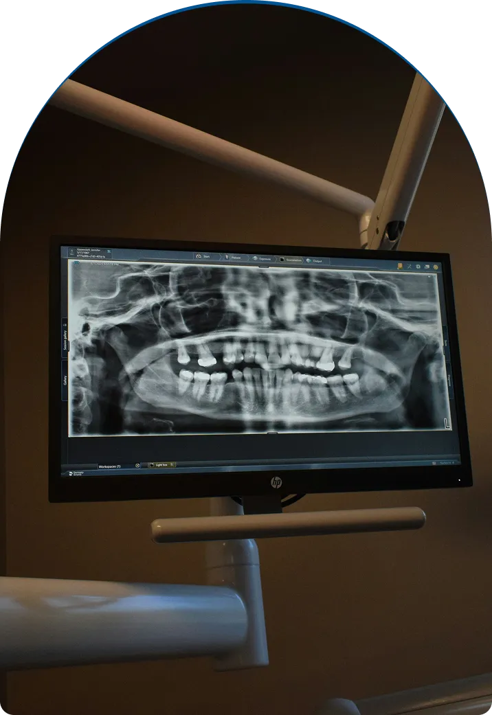 Inlays & Onlays near you