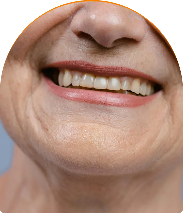 Inlays & Onlays near you