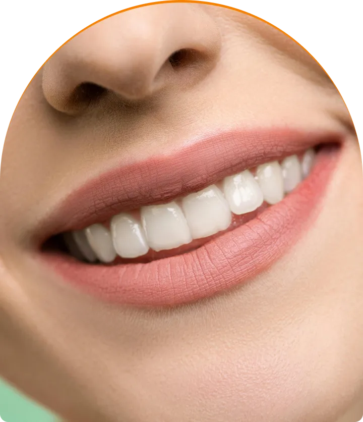 Inlays & Onlays near you