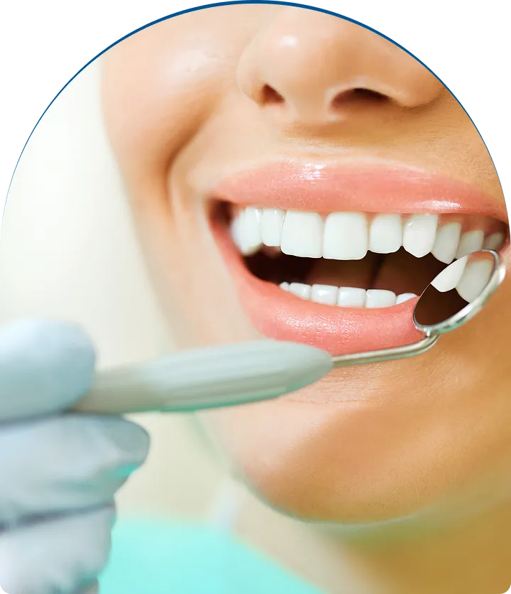 Inlays & Onlays near you