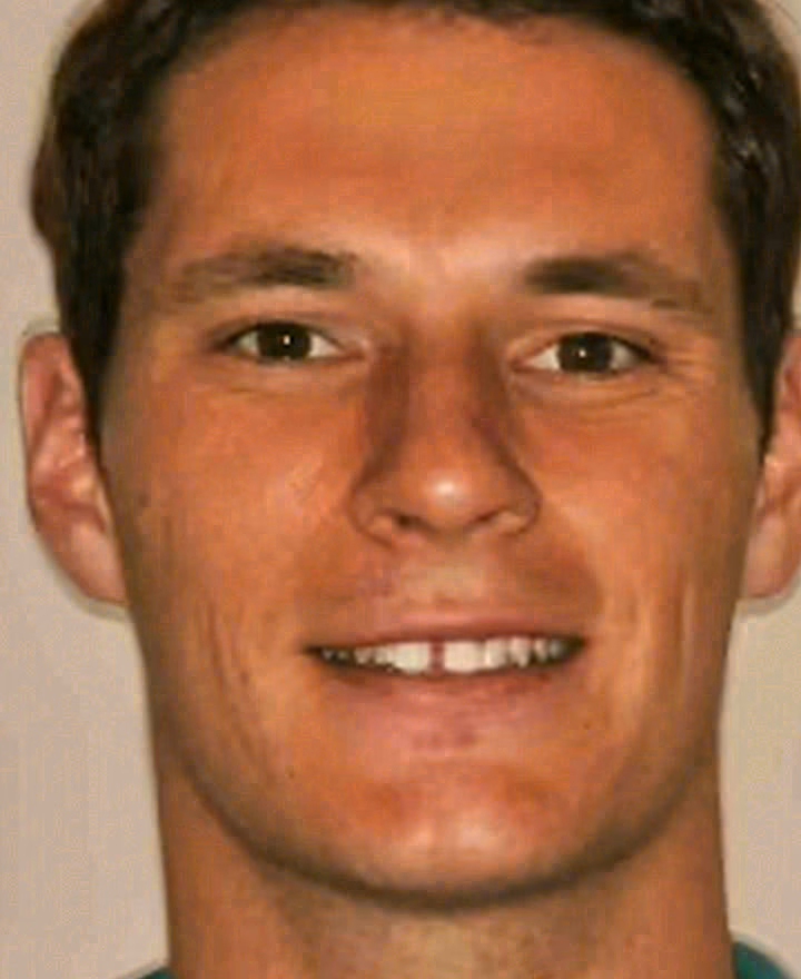 Before porcelain veneers at Sola Dental Spa