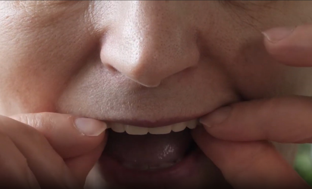 Testimonial from susan to kissimmee about dental implants