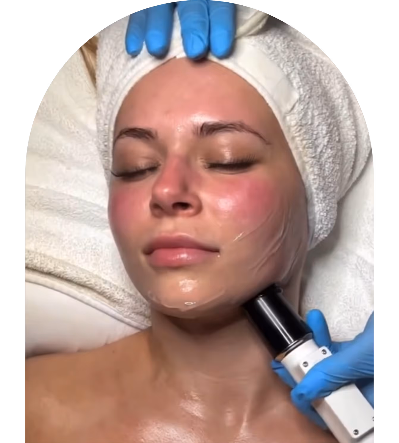 Woman receiving a dual wave facial at Better Med Spa