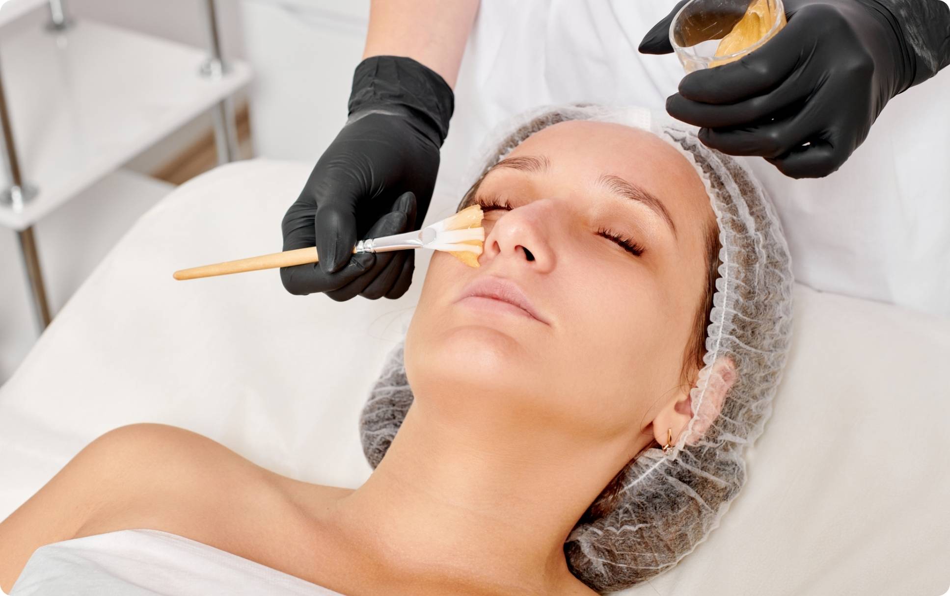 Chemical Peels in Chicago: Custom Solutions for Every Skin Type