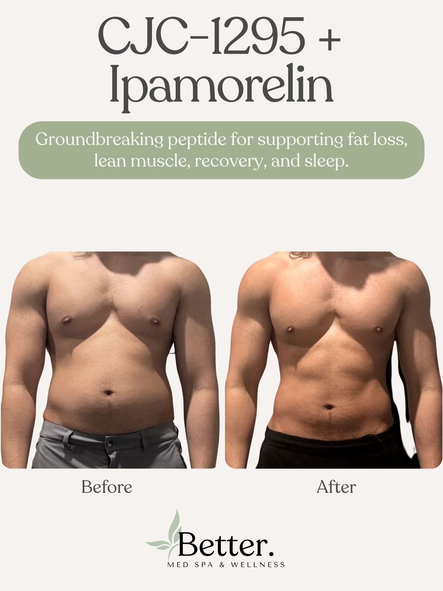 Real CJC-1295 + Ipamorelin transformation at Better Med Spa Chicago