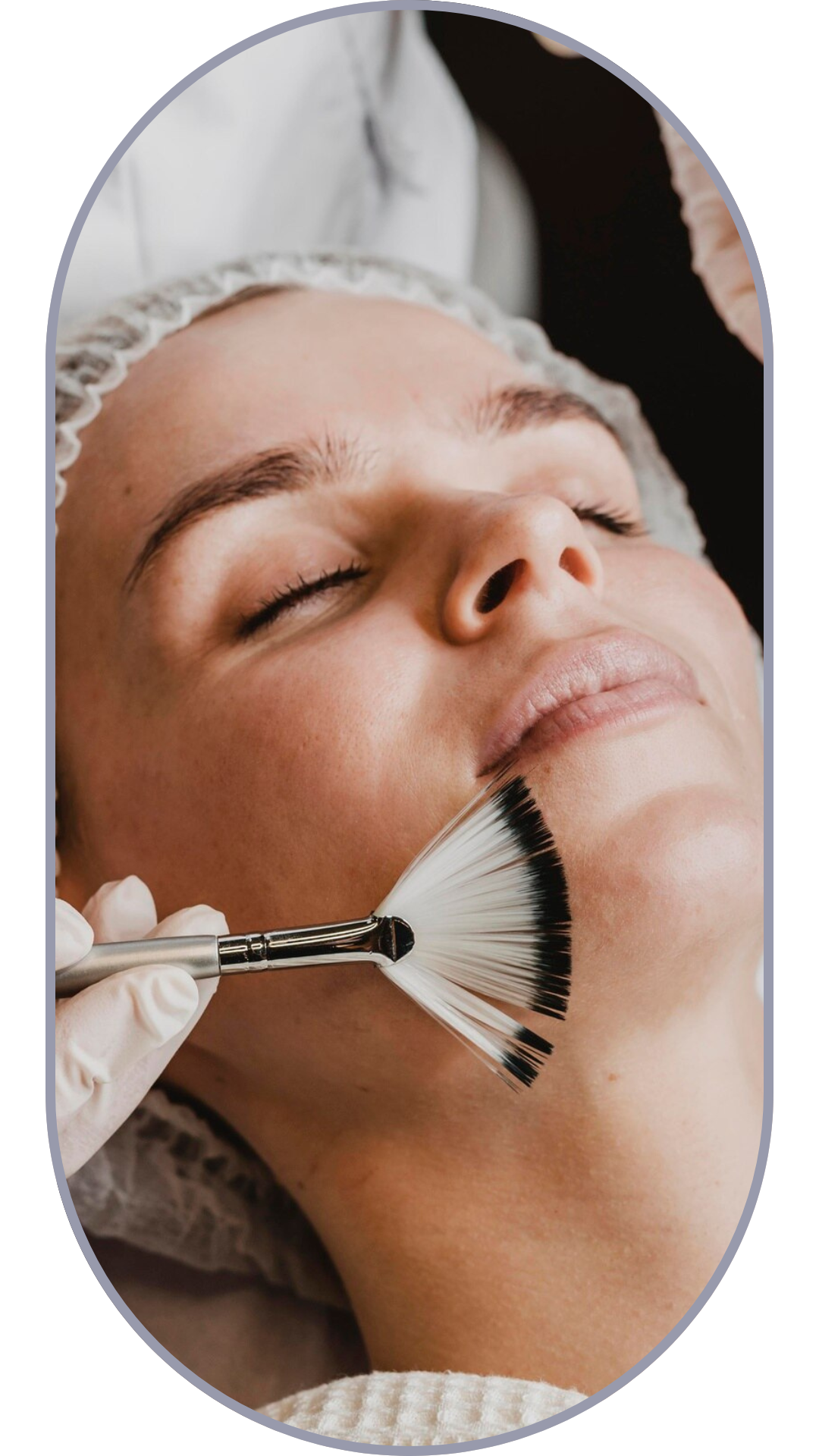 Chemical Peel