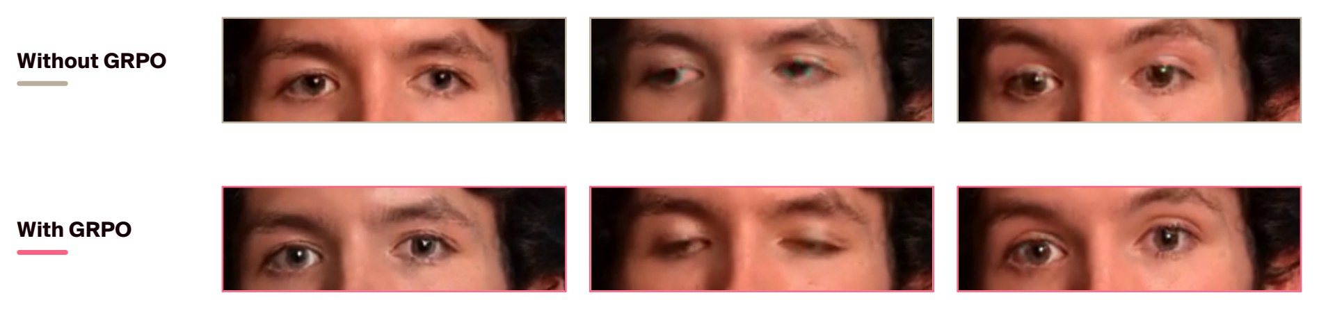 Eye regions without GRPO (top) and with GRPO (bottom)
