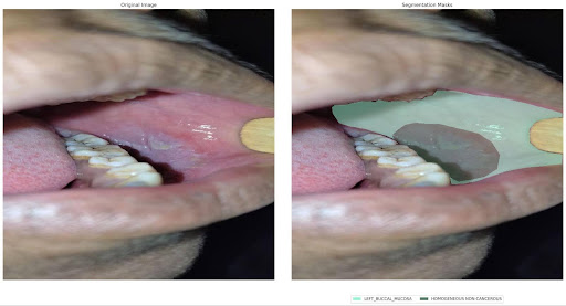 TissueAI segmentation example