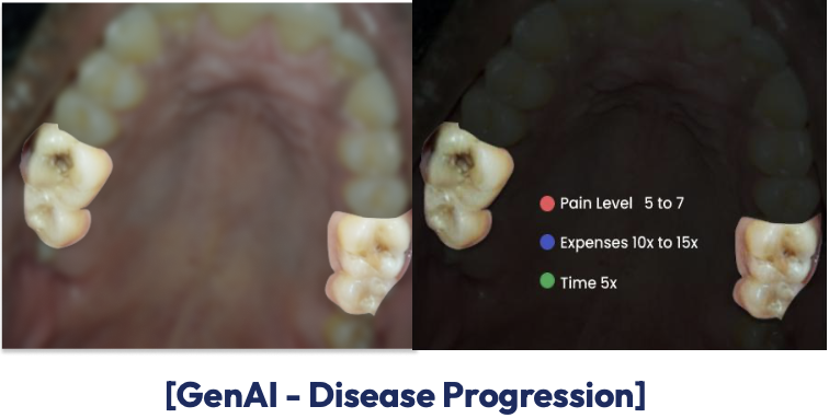 PredictAI progression example