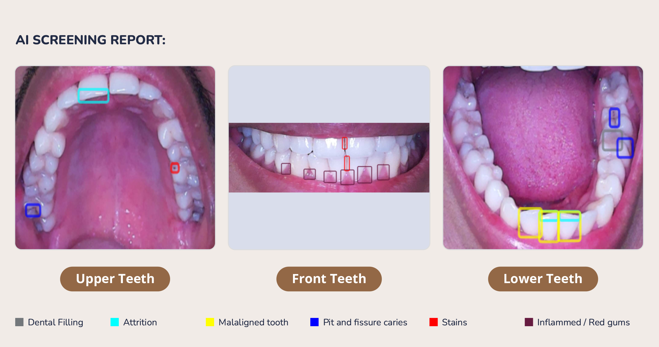 scanO AI screening report