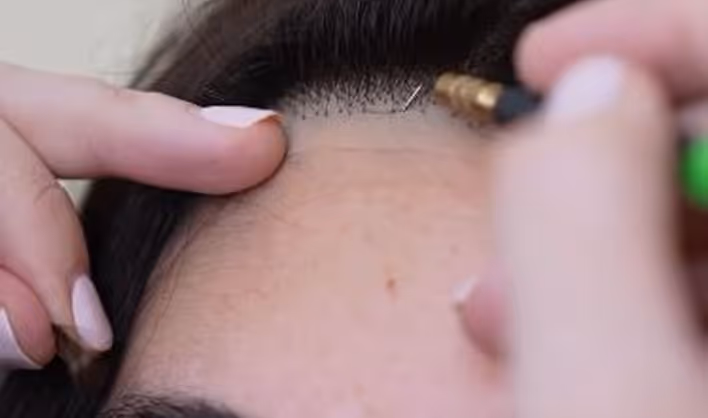 Main appliquant un microblading sur la racine des cheveux pour dessiner une ligne de cheveux naturelle.