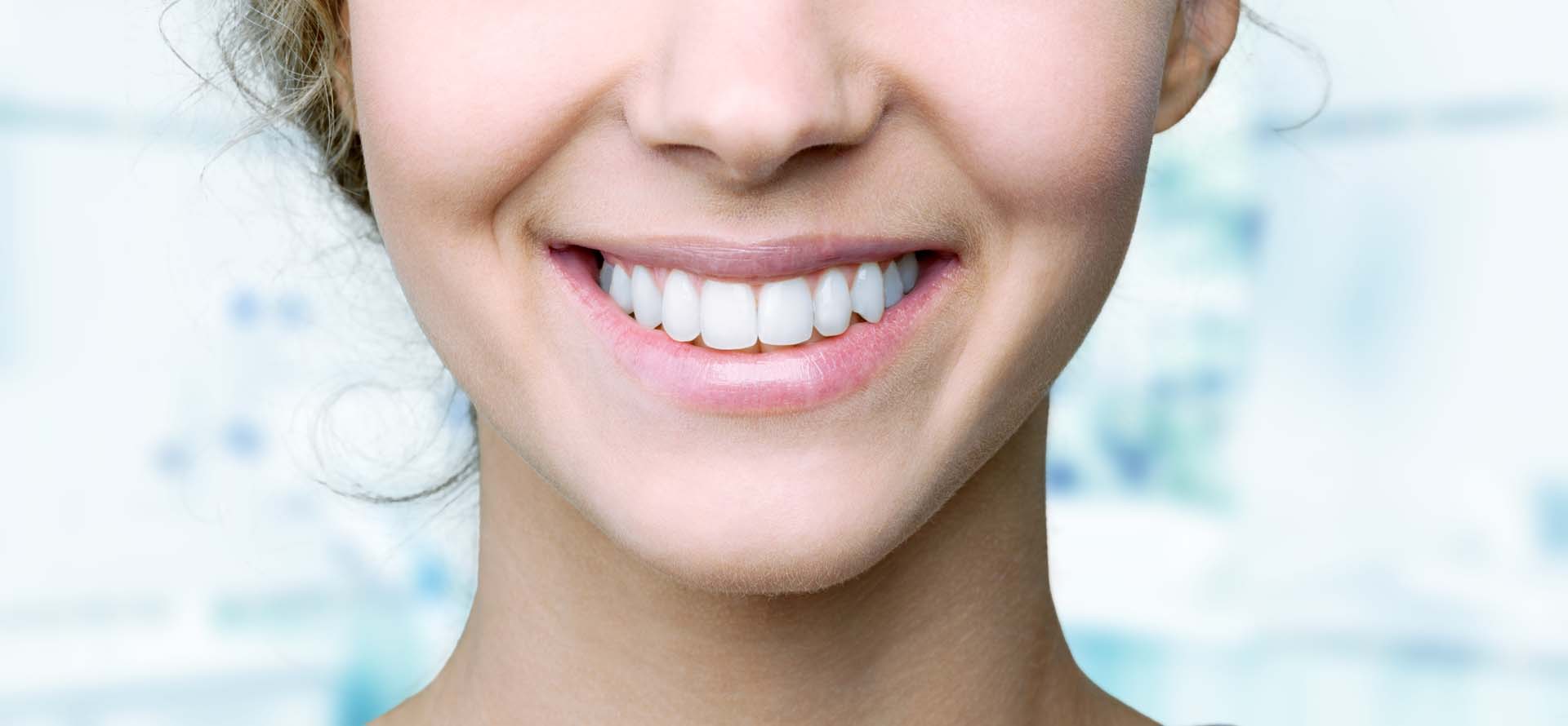 Snap-On Smiles