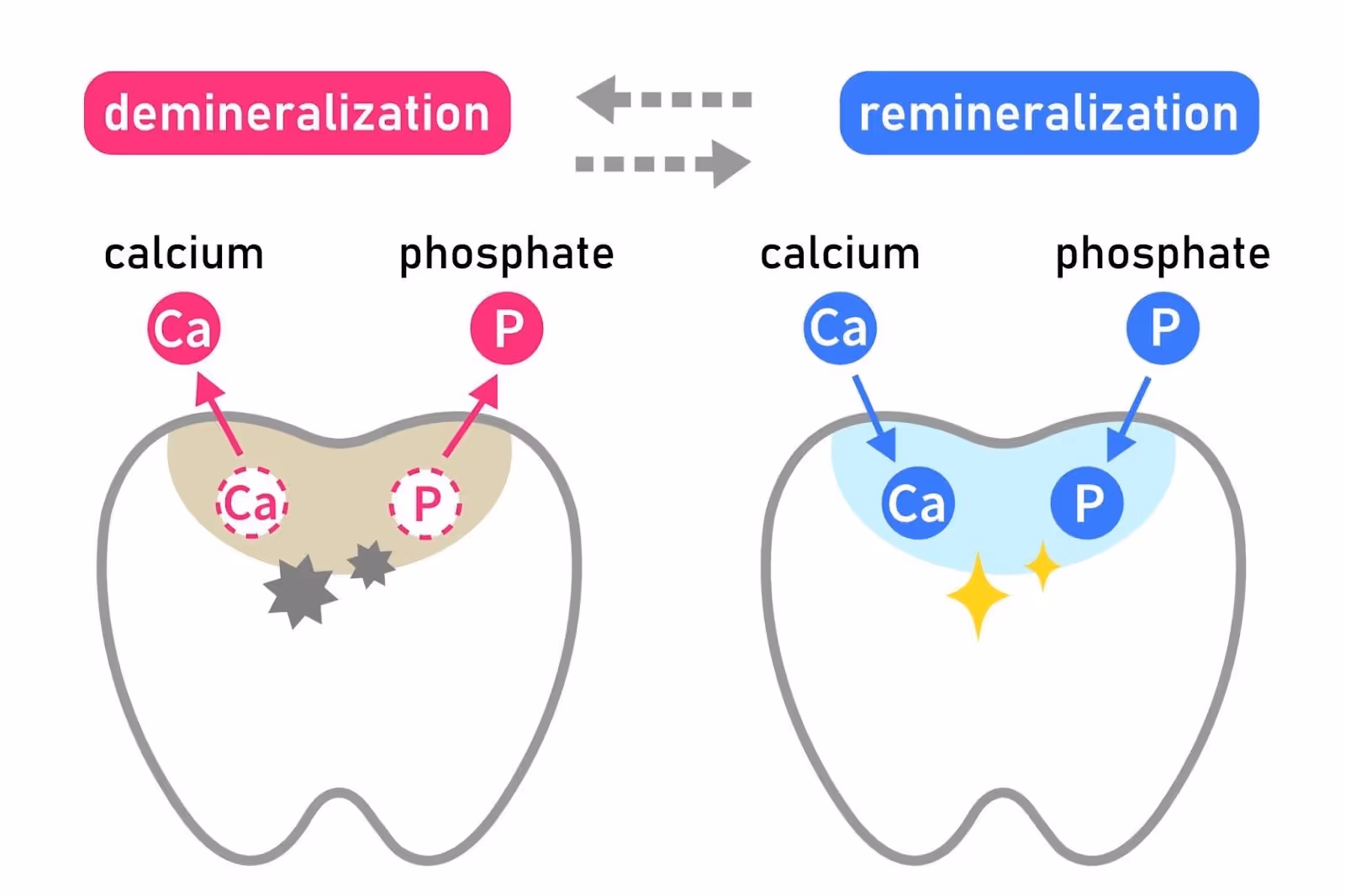 Image of tooth remineralization process