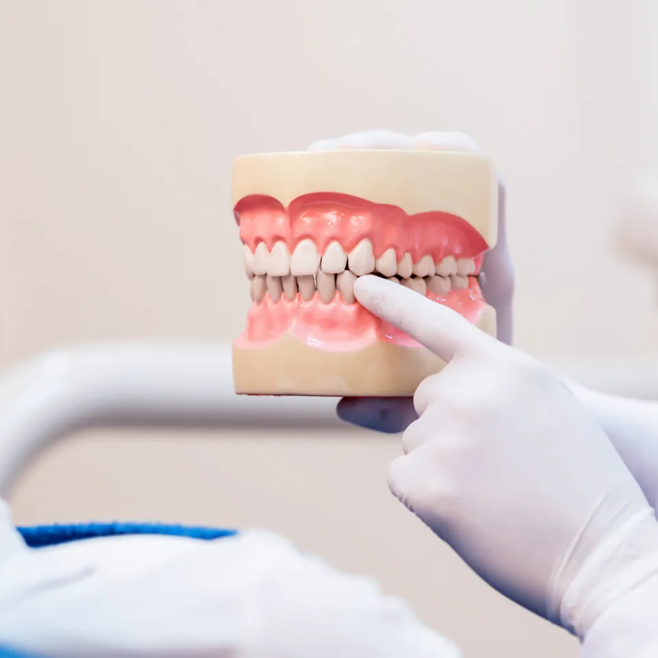 Achieving Your Best Smile in Davie, FL: Invisalign vs. Traditional Braces