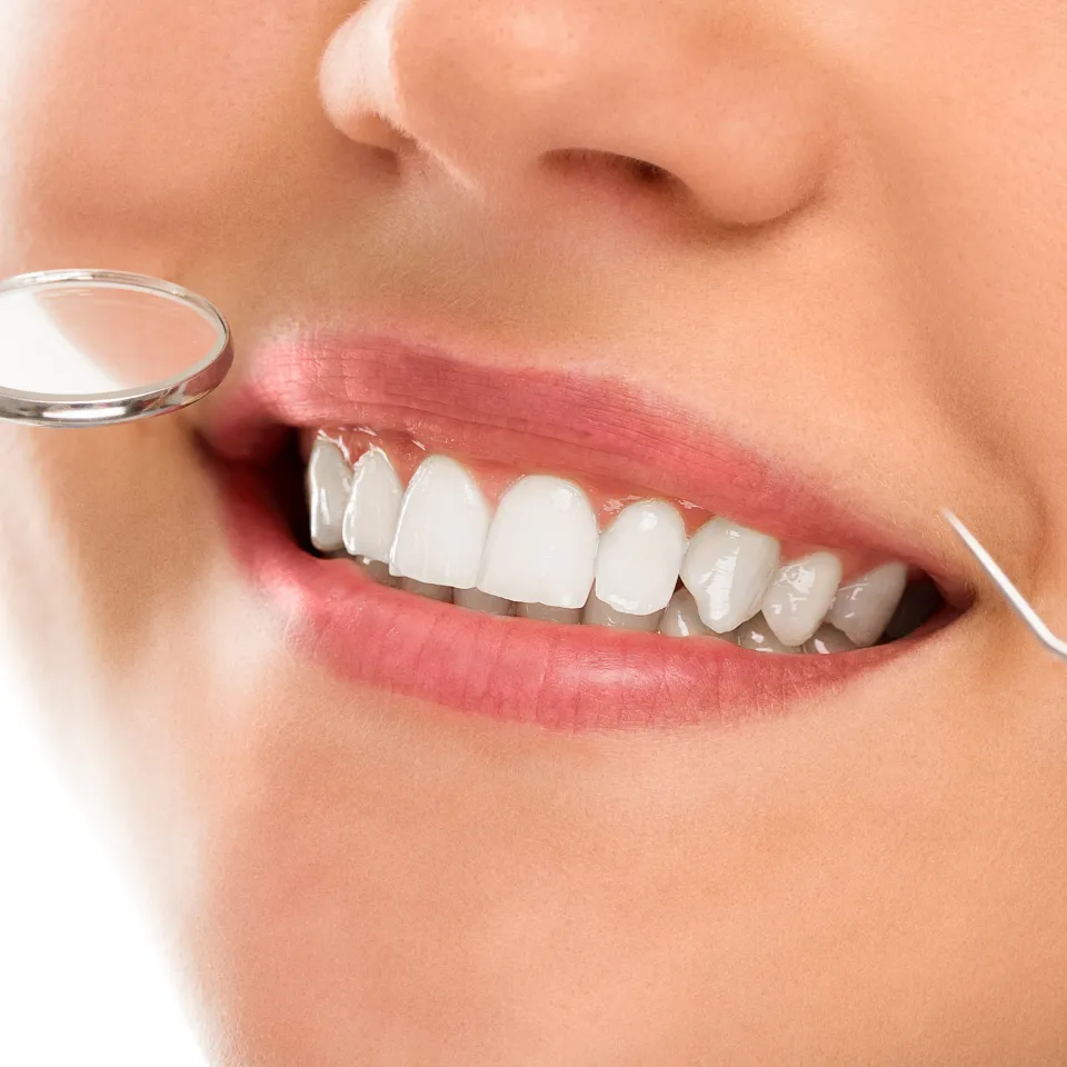 Achieving Dazzling Smiles in Davie, FL: How Long Does Teeth Whitening Last & Ensuring Long-Lasting Results