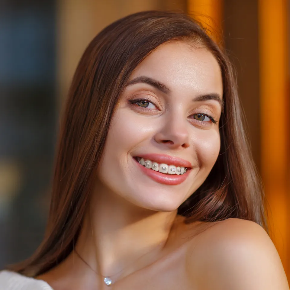 Elevate Your Smile in Chino, CA: The Art of Smile Design with Dentist Near Me Chino