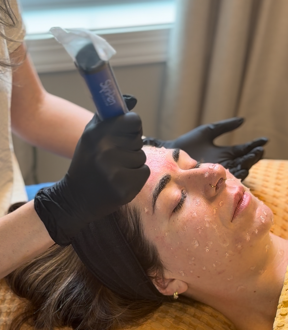 image of facial treatment being performed