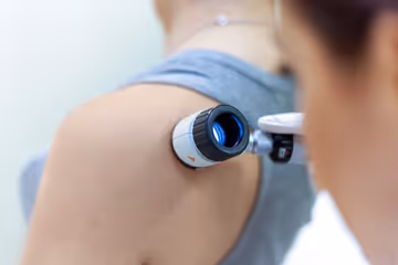 Close-up of a dermatologist examining a person's shoulder with a handheld dermatoscope.