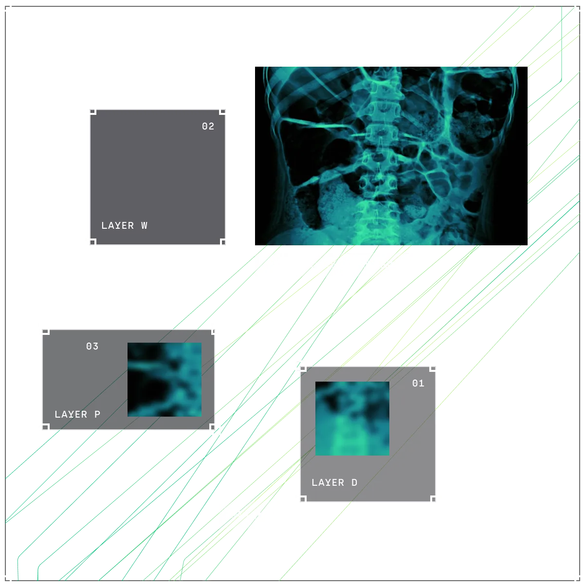 X-ray image of human torso with spine visible and three labeled layers: Layer W, Layer P, and Layer D, each showing blurred blue-green textures.