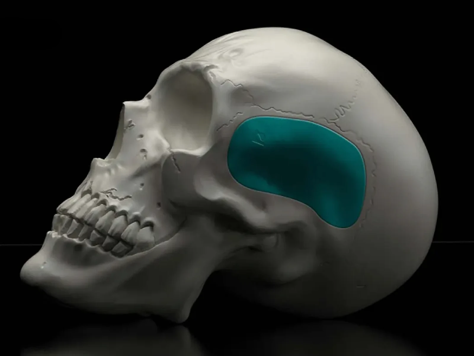Brand Design for Medical Implants
