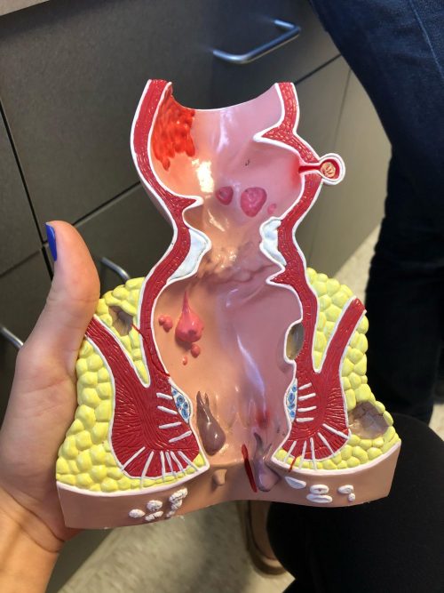 E7 C98 E72 3405 48 D2 8730 A2 E9807 D3 FED