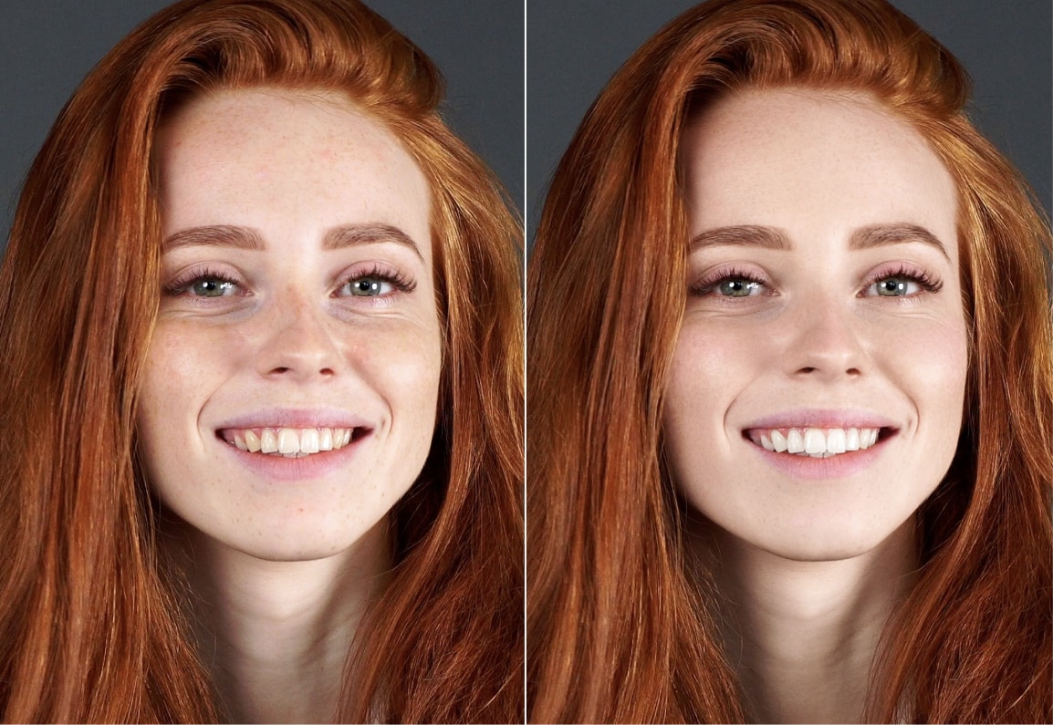 Before and after AI skin retouching with Retouch4me – natural texture preserved, freckles visible, even skin tone