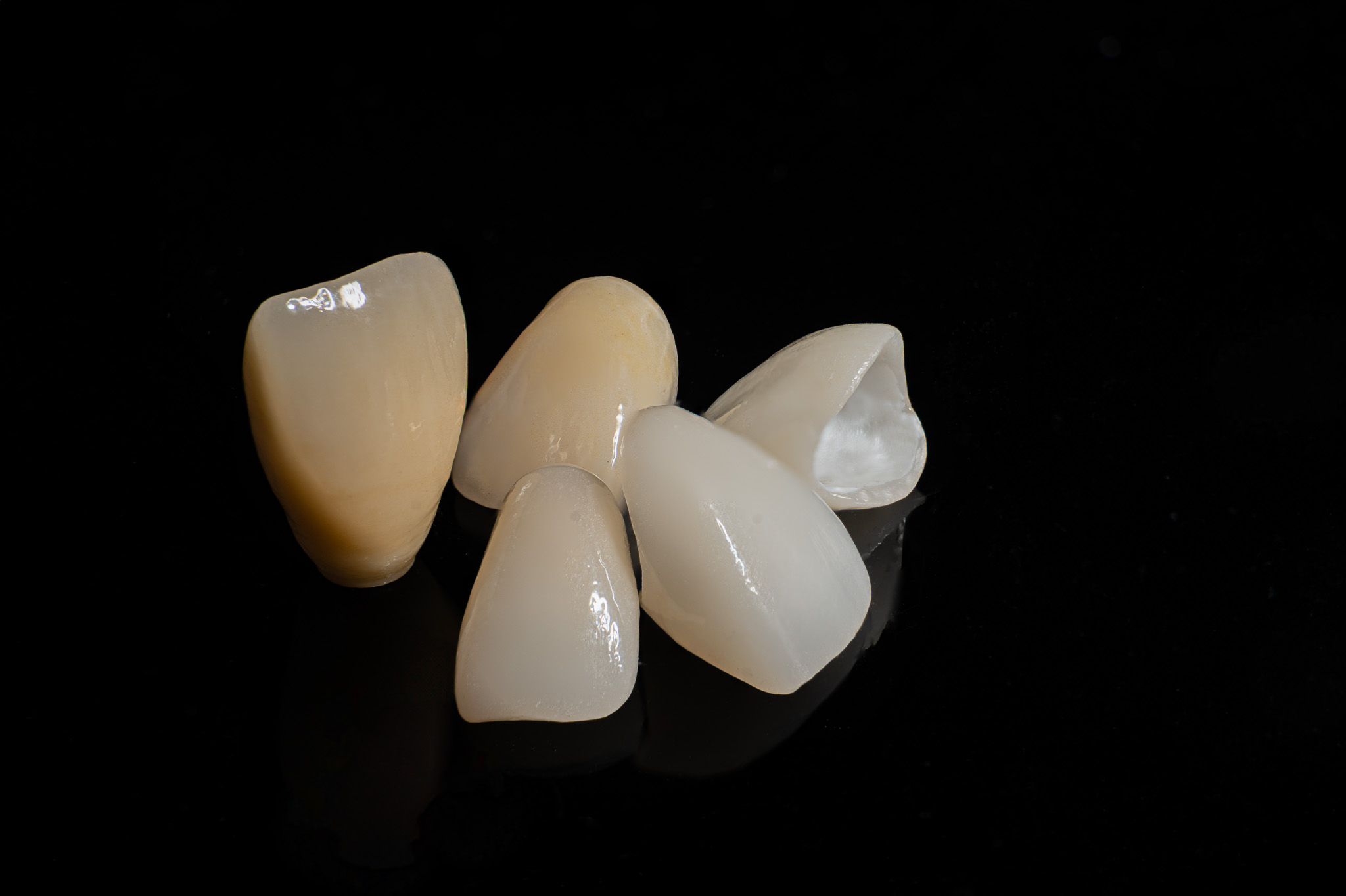 zirconia crown
