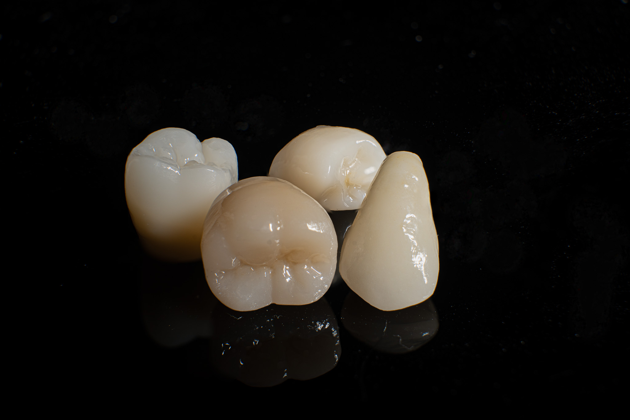 zirconia crown