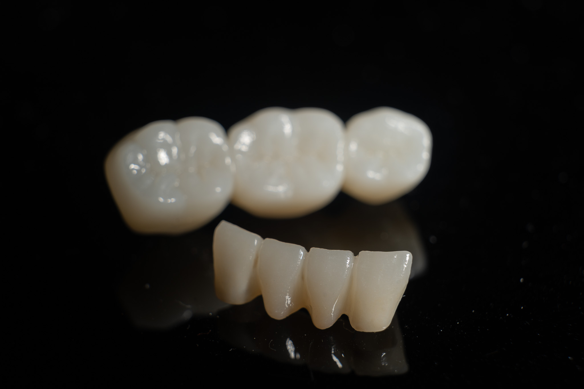 Zirconia Bridge