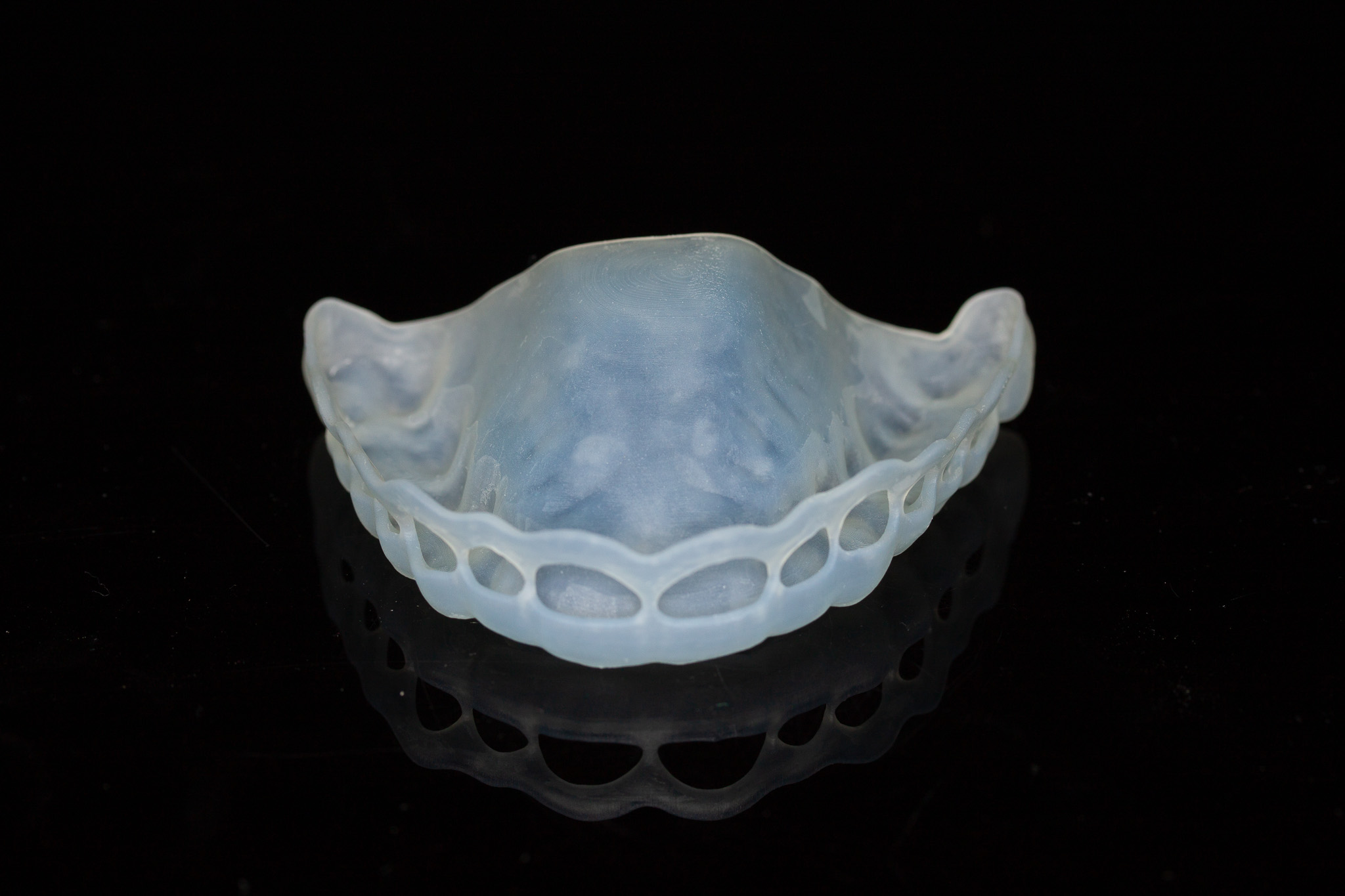 Crown Lengthening Guide
