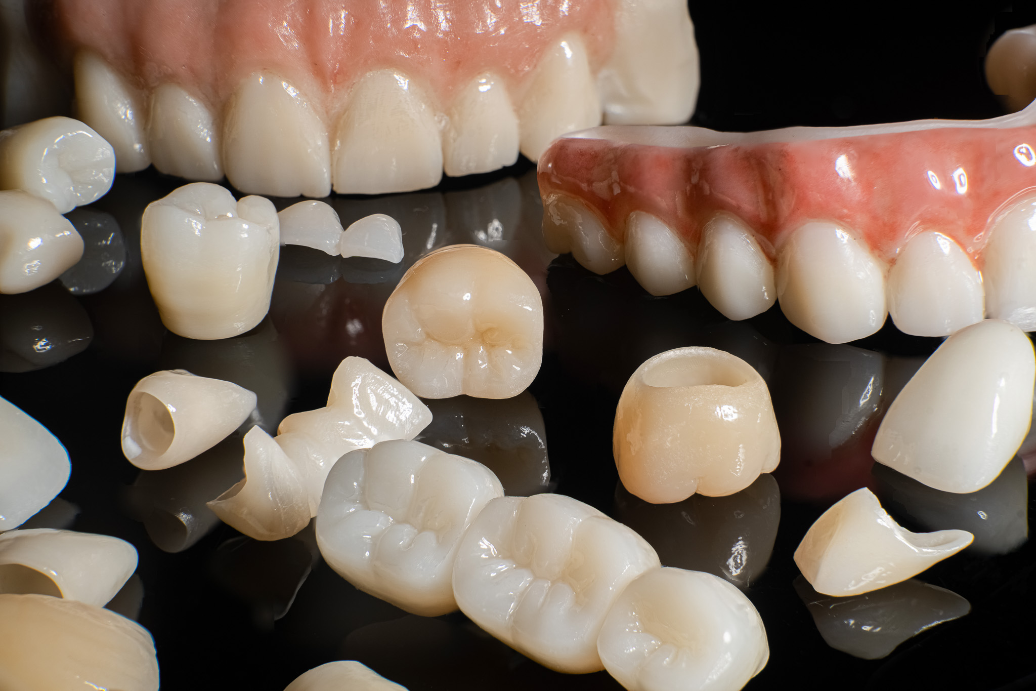 implant crown