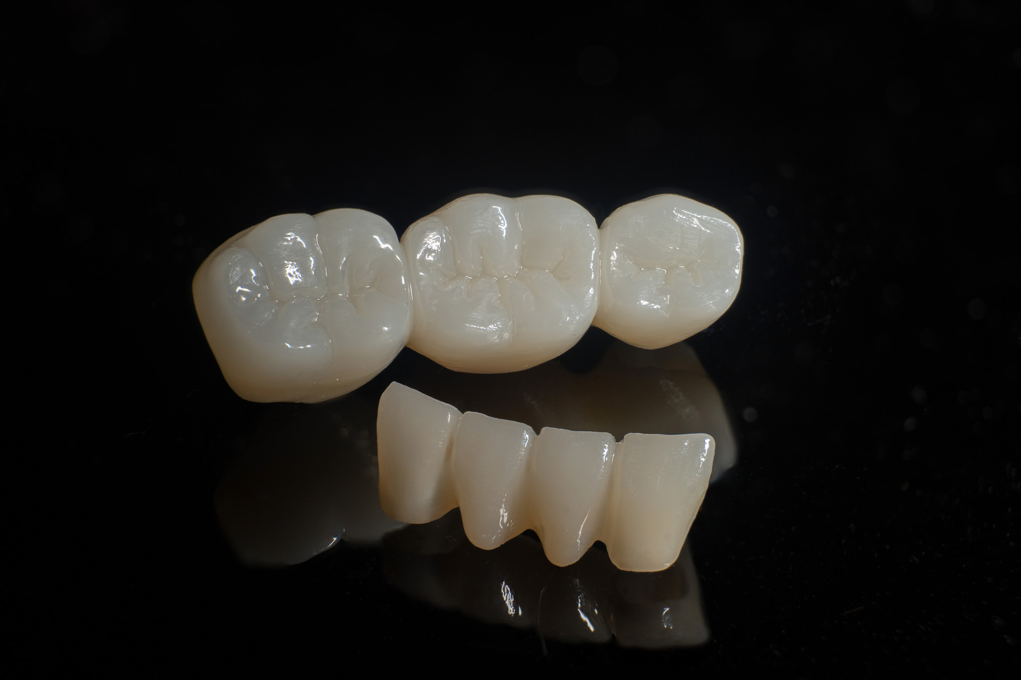 zirconia bridge