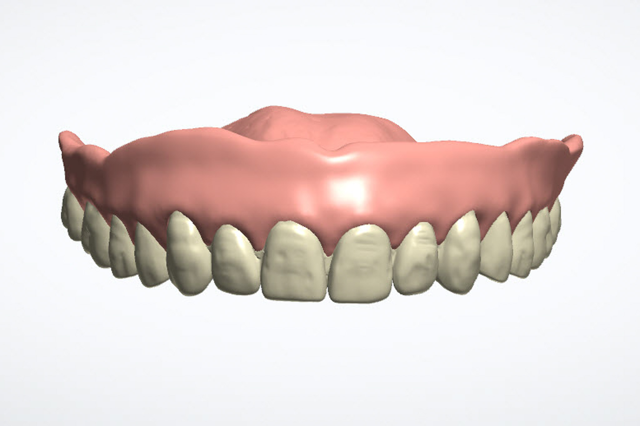 smile design